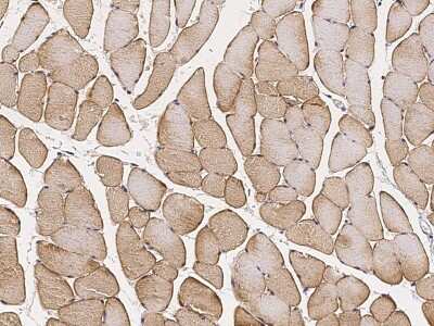 Immunohistochemistry-Paraffin: Caveolin-3 Antibody [NBP2-98712]