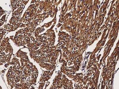 Immunohistochemistry-Paraffin: Caveolin-3 Antibody [NBP2-98712]