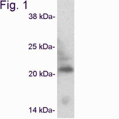 Western Blot: Caveolin-3 Antibody [NB110-5029]