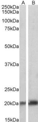 Western Blot: Caveolin-3 Antibody [NBP1-28917]