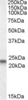 Western Blot: Caveolin-3 Antibody [NBP1-28917]