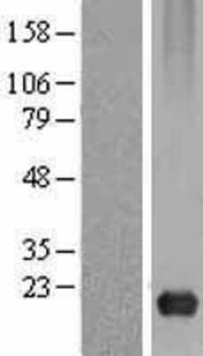 Western Blot: Caveolin-3 Overexpression Lysate [NBL1-08732]