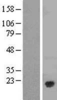 Western Blot: Caveolin-3 Overexpression Lysate [NBP2-05888]