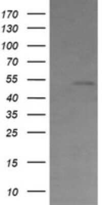 Western Blot: Cbl-c Antibody (OTI3B4) [NBP2-45587]