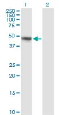 Western Blot: Cbl-c Antibody (3F10) [H00023624-M01]