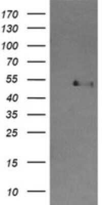 Western Blot: Cbl-c Antibody (OTI4E3) [NBP2-46072]