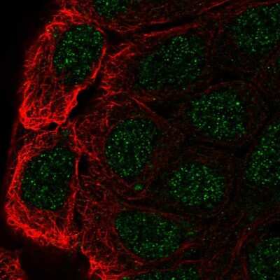 Immunocytochemistry/ Immunofluorescence: Cbl-c Antibody [NBP2-55259]