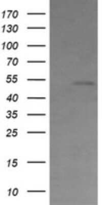 Western Blot: Cbl-c Antibody (OTI3B4)Azide and BSA Free [NBP2-71755]