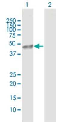 Western Blot: Cbl-c Antibody [H00023624-D01P]