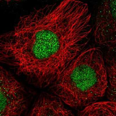 Immunocytochemistry/ Immunofluorescence: Cbx2 Antibody [NBP2-47524]