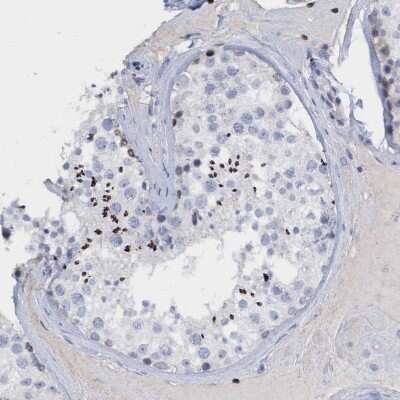 Immunohistochemistry-Paraffin: Cbx2 Antibody [NBP2-47524]