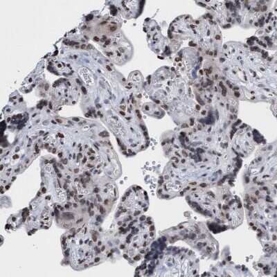 Immunohistochemistry-Paraffin: Cbx2 Antibody [NBP2-47524]