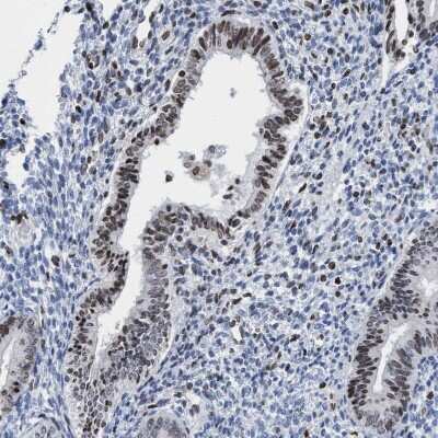 Immunohistochemistry-Paraffin: Cbx2 Antibody [NBP2-47524]