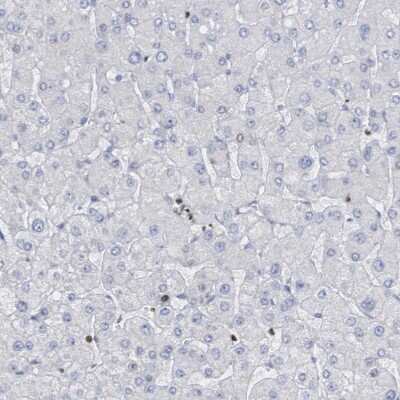 Immunohistochemistry-Paraffin: Cbx2 Antibody [NBP2-47524]