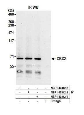 Immunoprecipitation: Cbx2 Antibody [NBP1-40342]