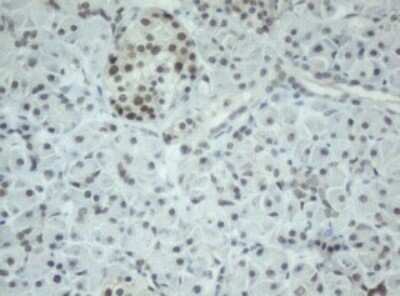 Immunohistochemistry: Cbx8 Antibody (OTI3D1) [NBP2-46073]