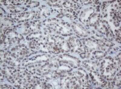 Immunohistochemistry: Cbx8 Antibody (OTI3D1) [NBP2-46073]