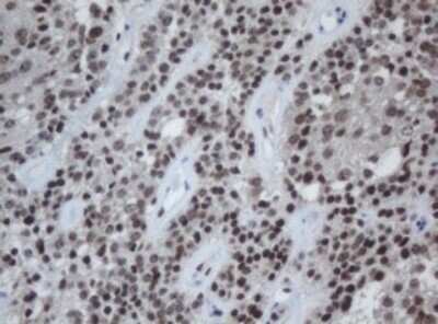 Immunohistochemistry: Cbx8 Antibody (OTI3D1) - Azide and BSA Free [NBP2-72087]