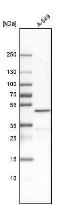 Western Blot: Cbx8 Antibody [NBP1-83224]