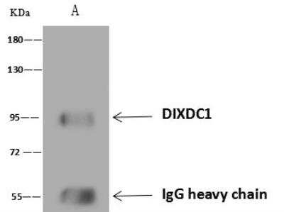 Immunoprecipitation: Ccd1/DIXDC1 Antibody [NBP3-12691]