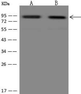 Western Blot: Ccd1/DIXDC1 Antibody [NBP3-12691]