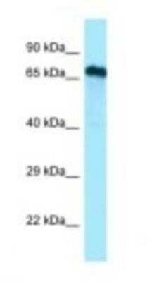 Western Blot: Cdc14A Antibody [NBP1-98508]