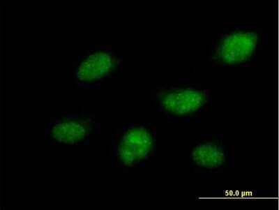 Immunocytochemistry/ Immunofluorescence: Cdc14B Antibody [H00008555-B01P]