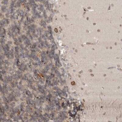 Immunohistochemistry-Paraffin: Cdc14B Antibody [NBP1-84572]