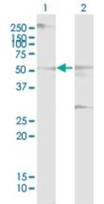 Western Blot: Cdc14B Antibody [H00008555-B01P]