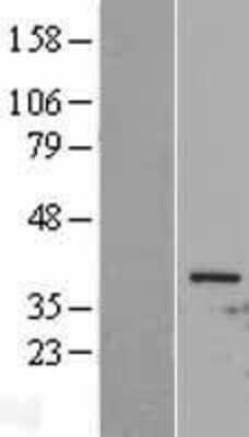 Western Blot: CDC2/CDK1 Overexpression Lysate [NBL1-08991]