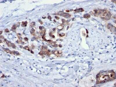 Immunohistochemistry-Paraffin: Cdc20 Antibody (AR12) - Azide and BSA Free [NBP2-34552]