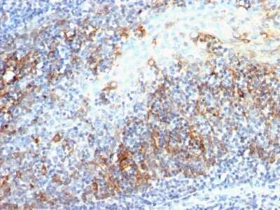 Immunohistochemistry-Paraffin: Cdc20 Antibody (AR12) - Azide and BSA Free [NBP2-34552]