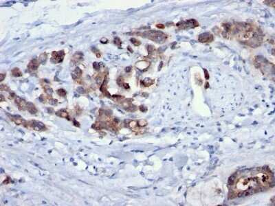 Immunohistochemistry-Paraffin: Cdc20 Antibody (AR12) - IHC-Prediluted [NBP2-44406]