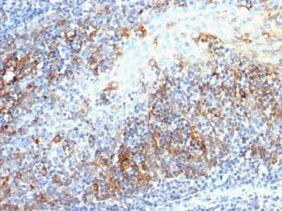 Immunohistochemistry-Paraffin: Cdc20 Antibody (AR12) - IHC-Prediluted [NBP2-44406]