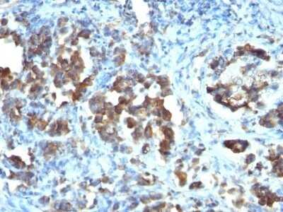 Immunohistochemistry-Paraffin: Cdc20 Antibody (CDC20/1102) - Azide and BSA Free [NBP2-47811]