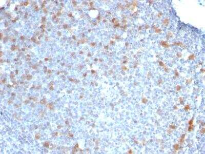 Immunohistochemistry-Paraffin: Cdc20 Antibody (CDC20/1102) - IHC-Prediluted [NBP2-48037]