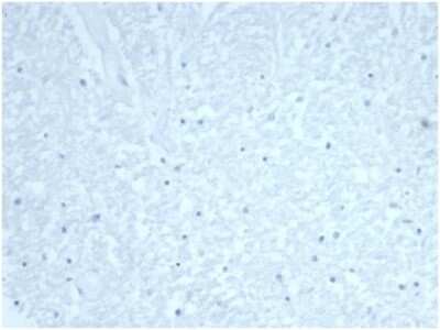 Immunohistochemistry-Paraffin: Cdc20 Antibody (CDC20/7026R) [NBP3-13820]