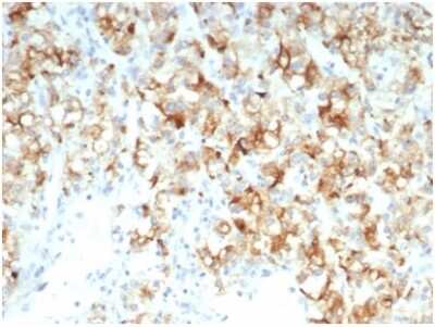 Immunohistochemistry-Paraffin: Cdc20 Antibody (CDC20/7026R) [NBP3-13820]
