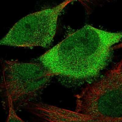 Immunocytochemistry/ Immunofluorescence: Cdc20 Antibody [NBP2-58408]