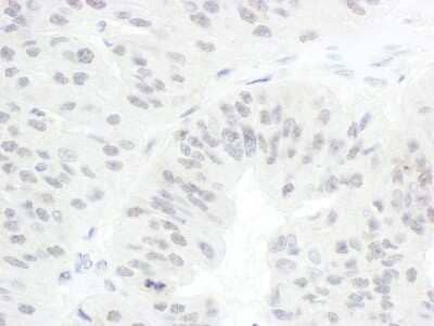 Immunohistochemistry-Paraffin: Cdc20 Antibody [NB100-59827]