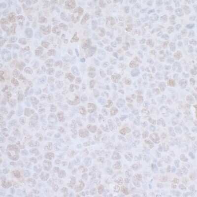 Immunohistochemistry-Paraffin: Cdc20 Antibody [NB100-59828]