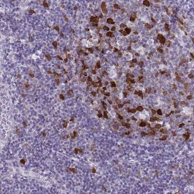 Immunohistochemistry-Paraffin: Cdc20 Antibody [NBP2-38750]