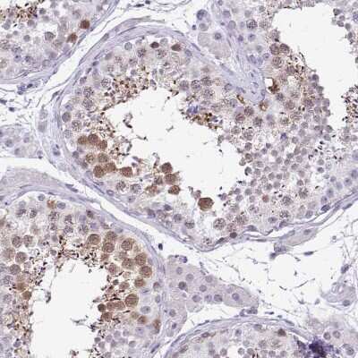 Immunohistochemistry-Paraffin: Cdc20 Antibody [NBP2-38750]