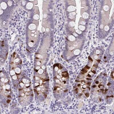 Immunohistochemistry-Paraffin: Cdc20 Antibody [NBP2-38750]