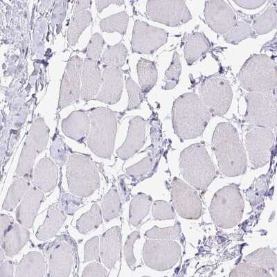 Immunohistochemistry-Paraffin: Cdc20 Antibody [NBP2-38750]