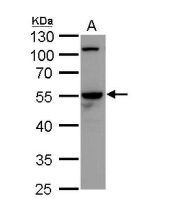 Western Blot: Cdc20 Antibody [NBP2-15825]