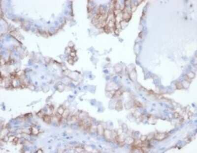 Immunohistochemistry-Paraffin: Cdc20 Antibody (rCDC20/7184) [NBP3-13819]