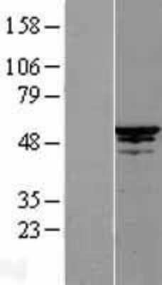 Western Blot: Cdc20 Overexpression Lysate [NBL1-08992]