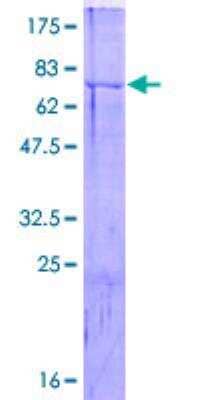 SDS-PAGE: Recombinant Human Cdc20 GST (N-Term) Protein [H00000991-P01]