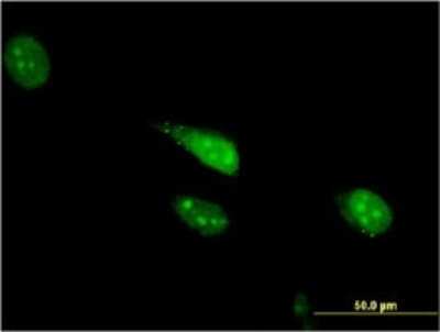 Immunocytochemistry/ Immunofluorescence: Cdc23 Antibody (1F3) [H00008697-M08]